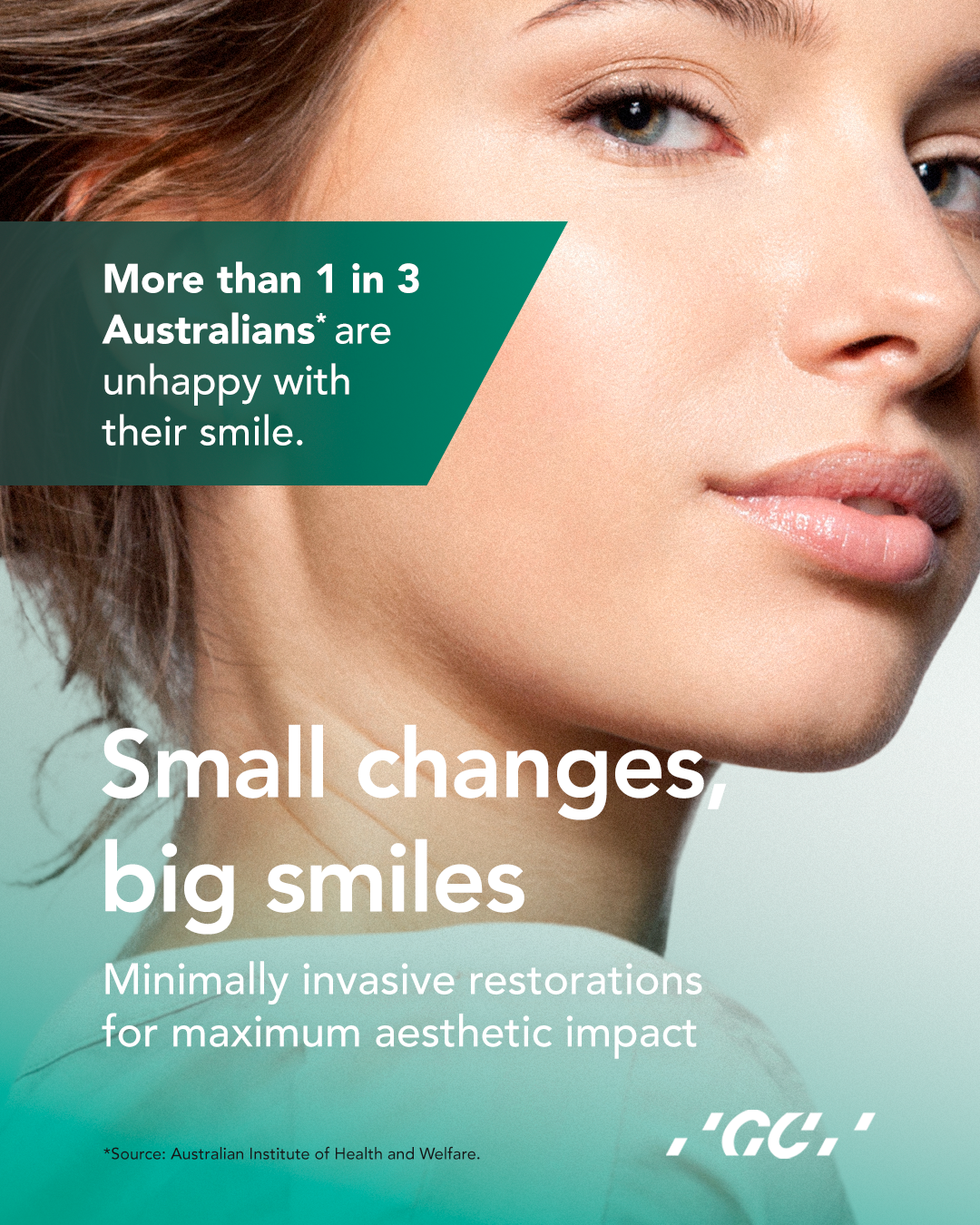 Small Changes, Big Smiles Minimally Invasive Dentistry for Maximum Aesthetic Impact